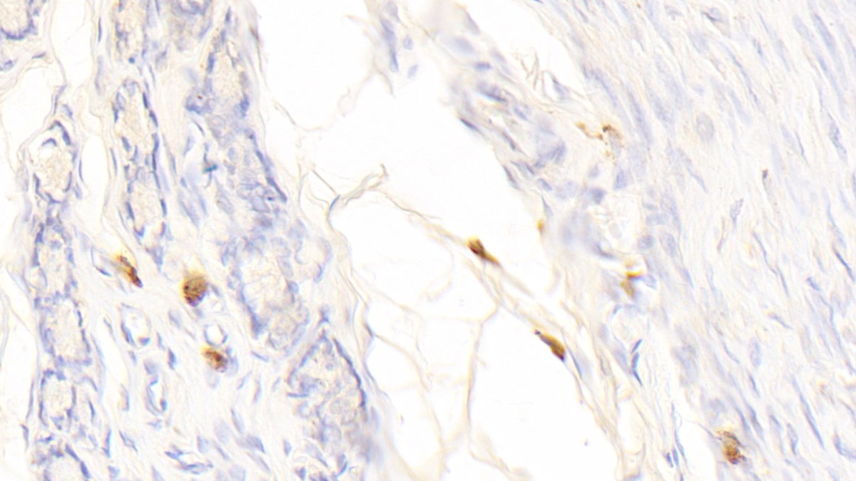 Polyclonal Antibody to Tryptase (TPS)