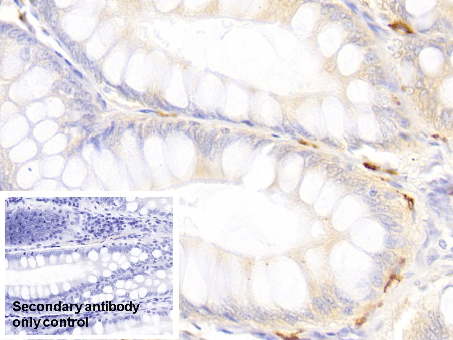 Polyclonal Antibody to Tryptase (TPS)