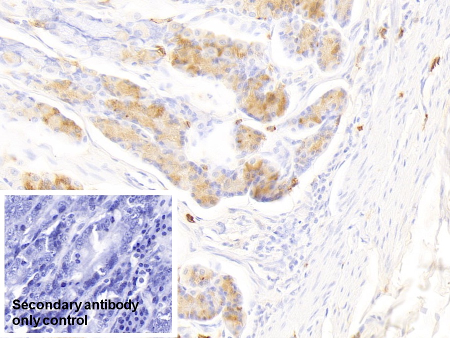 Polyclonal Antibody to Tryptase (TPS)