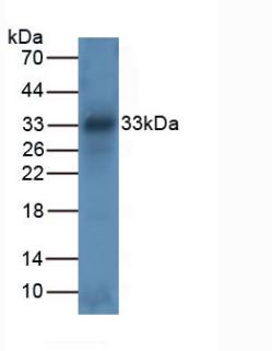 Polyclonal Antibody to Tryptase (TPS)