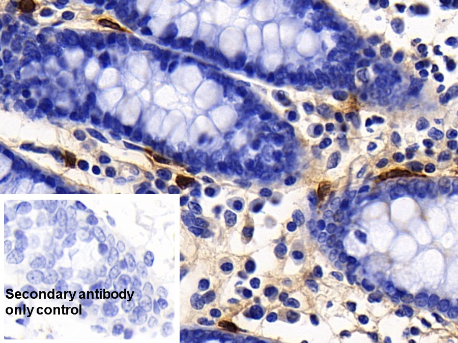 Polyclonal Antibody to Tryptase (TPS)