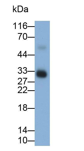 Polyclonal Antibody to Tryptase (TPS)