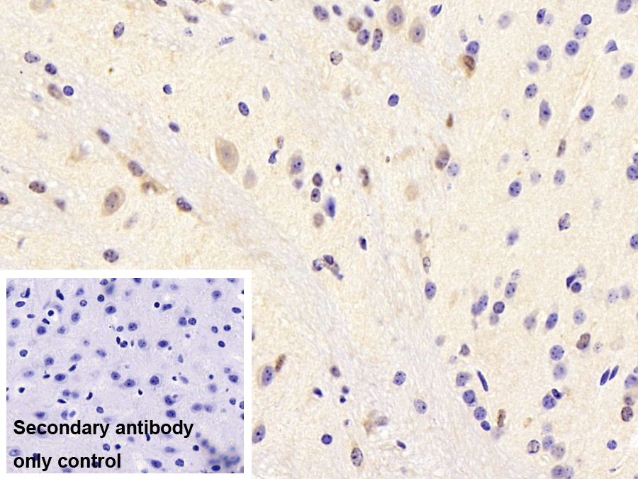 Polyclonal Antibody to General Transcription Factor IIH Subunit 1 (GTF2H1)