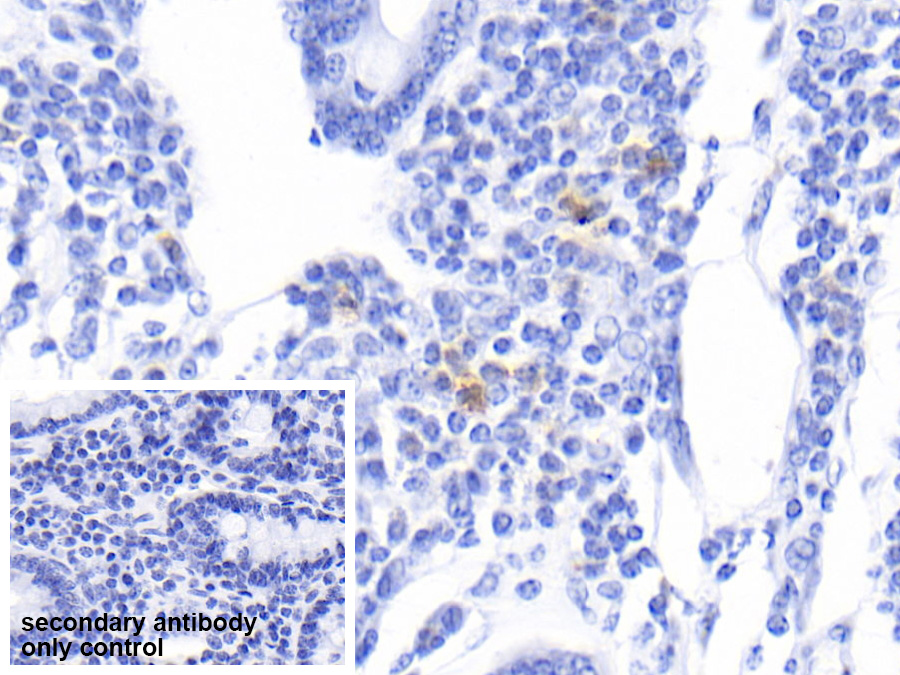 Polyclonal Antibody to S100 Calcium Binding Protein A12 (S100A12)