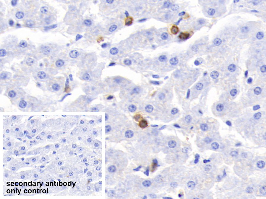 Polyclonal Antibody to S100 Calcium Binding Protein A12 (S100A12)