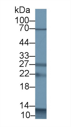 Polyclonal Antibody to S100 Calcium Binding Protein A12 (S100A12)