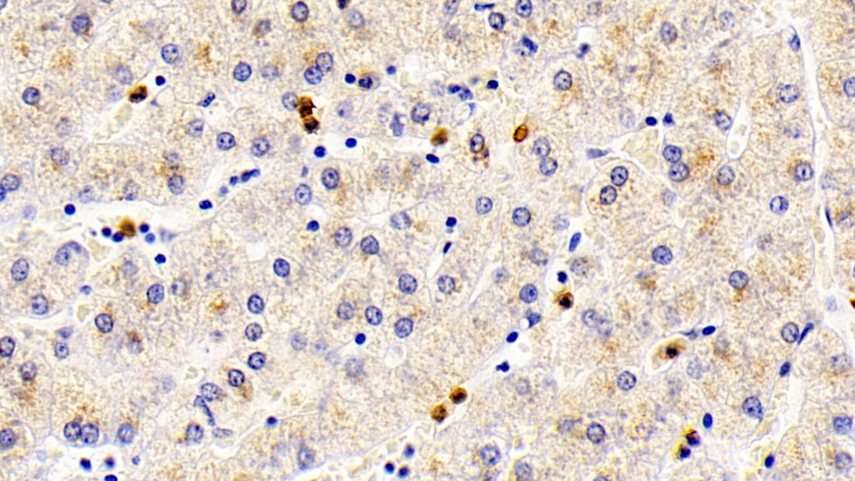 Polyclonal Antibody to S100 Calcium Binding Protein A12 (S100A12)