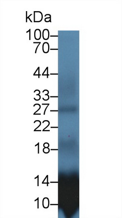 Polyclonal Antibody to S100 Calcium Binding Protein A12 (S100A12)