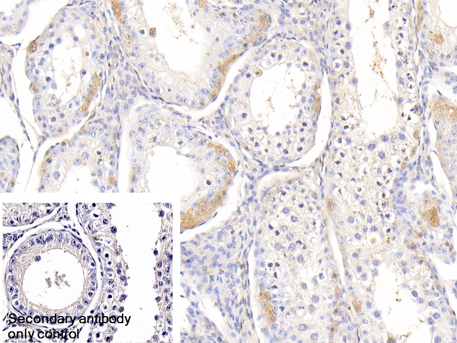 Polyclonal Antibody to Heat Shock 70kDa Protein 1A (HSPA1A)