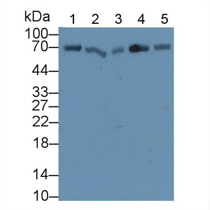 Polyclonal Antibody to Heat Shock 70kDa Protein 1A (HSPA1A)