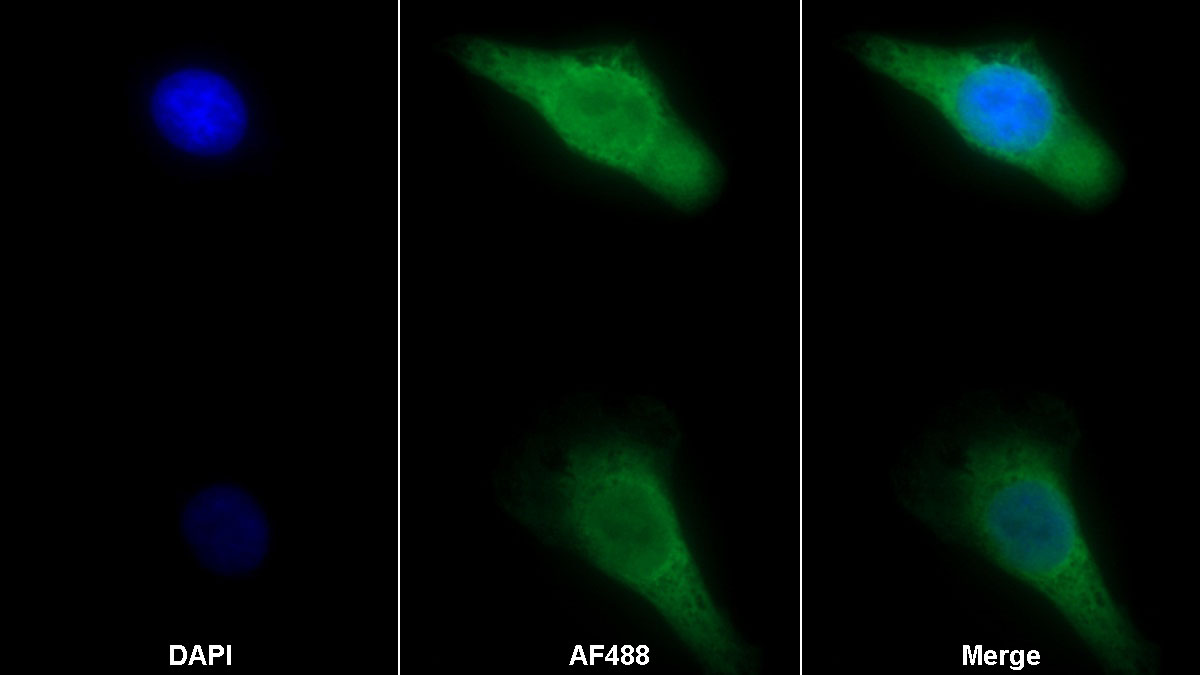 Polyclonal Antibody to Heat Shock 70kDa Protein 1A (HSPA1A)