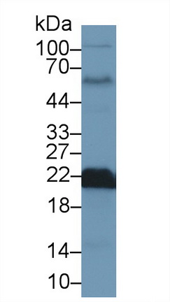 Polyclonal Antibody to Superoxide Dismutase 2, Mitochondrial (SOD2)