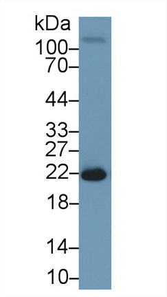 Polyclonal Antibody to Superoxide Dismutase 2, Mitochondrial (SOD2)