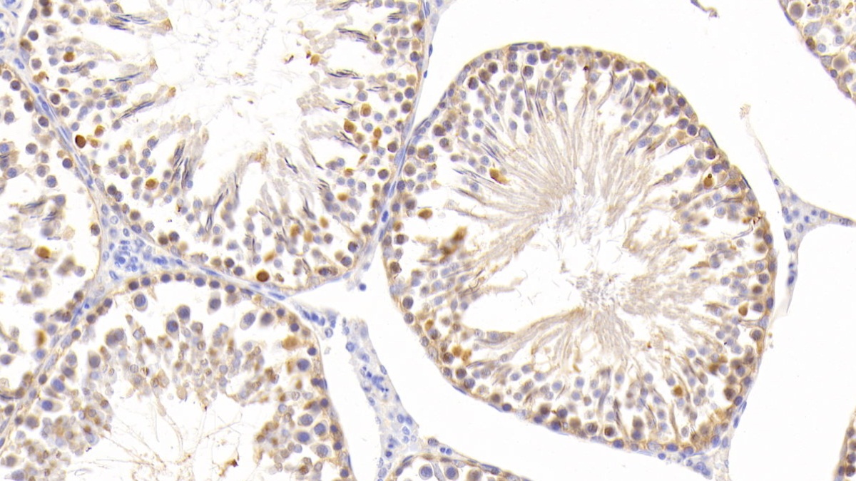 Polyclonal Antibody to Superoxide Dismutase 2, Mitochondrial (SOD2)