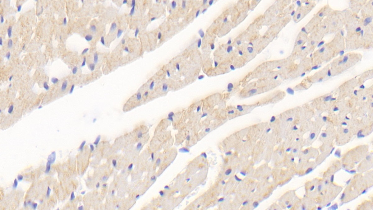 Polyclonal Antibody to Superoxide Dismutase 2, Mitochondrial (SOD2)