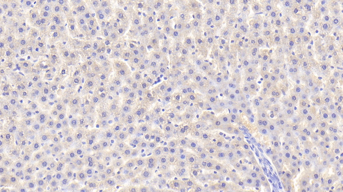 Polyclonal Antibody to Superoxide Dismutase 2, Mitochondrial (SOD2)