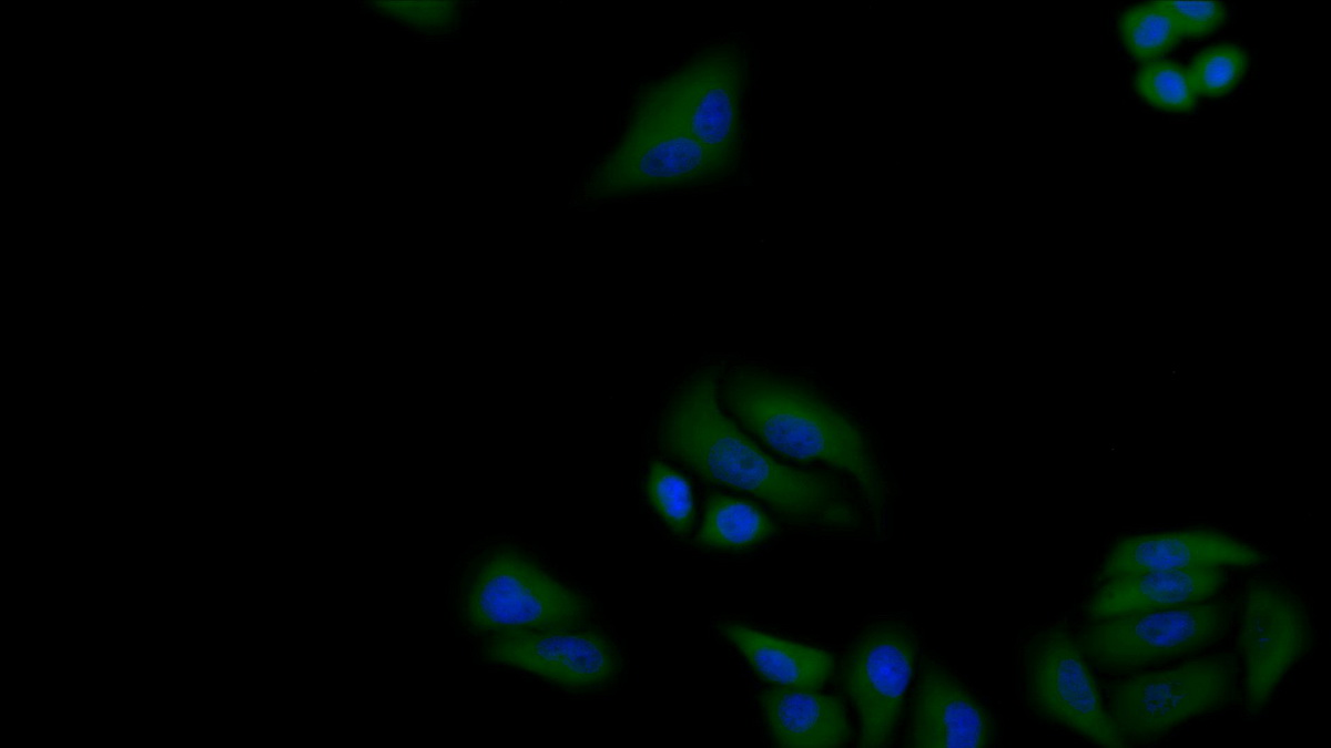 Polyclonal Antibody to Superoxide Dismutase 2, Mitochondrial (SOD2)