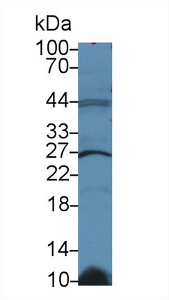 Polyclonal Antibody to Glutathione S Transferase Kappa 1 (GSTk1)