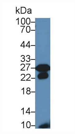 Polyclonal Antibody to Glutathione S Transferase Kappa 1 (GSTk1)