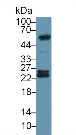 Polyclonal Antibody to Glutathione S Transferase Pi (GSTp)