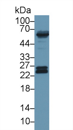 Polyclonal Antibody to Glutathione S Transferase Pi (GSTp)