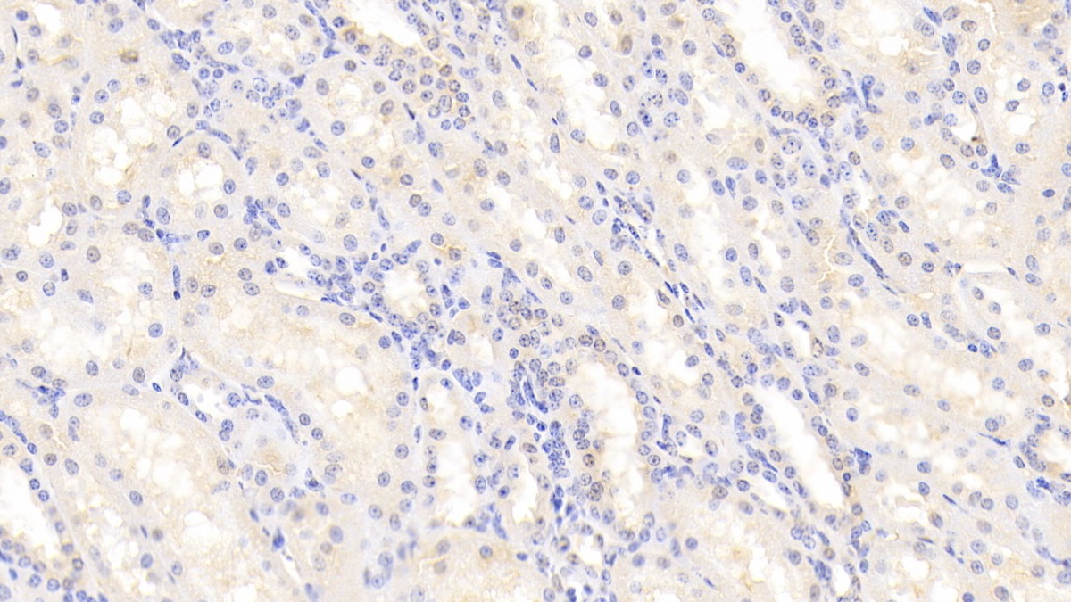 Polyclonal Antibody to Glutathione S Transferase Pi (GSTp)