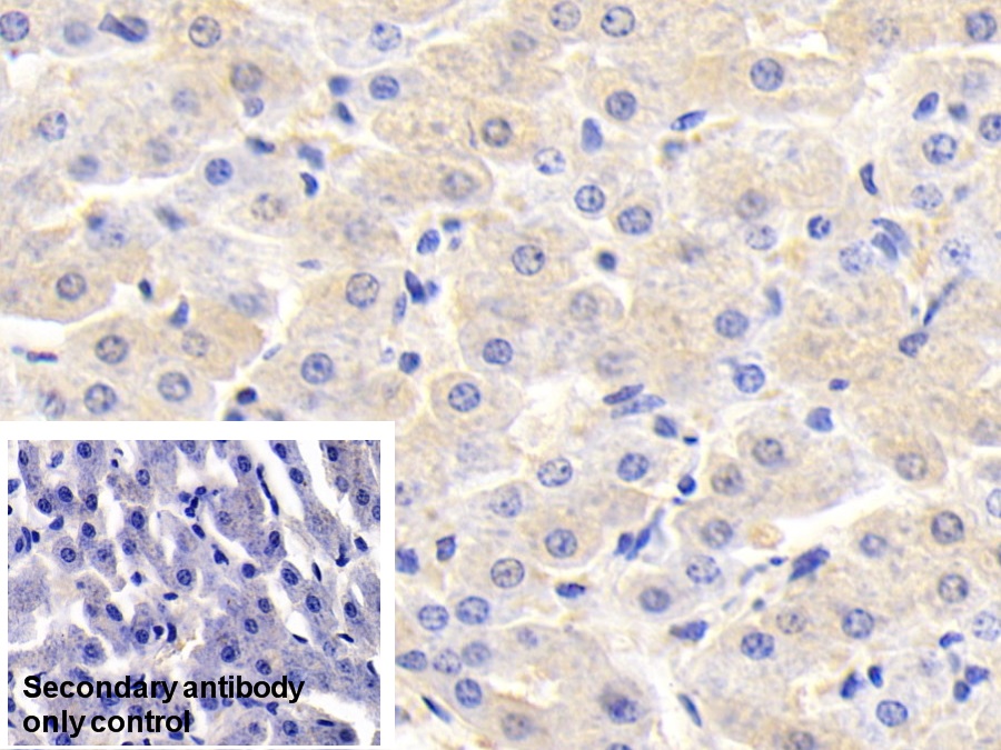 Polyclonal Antibody to Glutathione S Transferase Pi (GSTp)