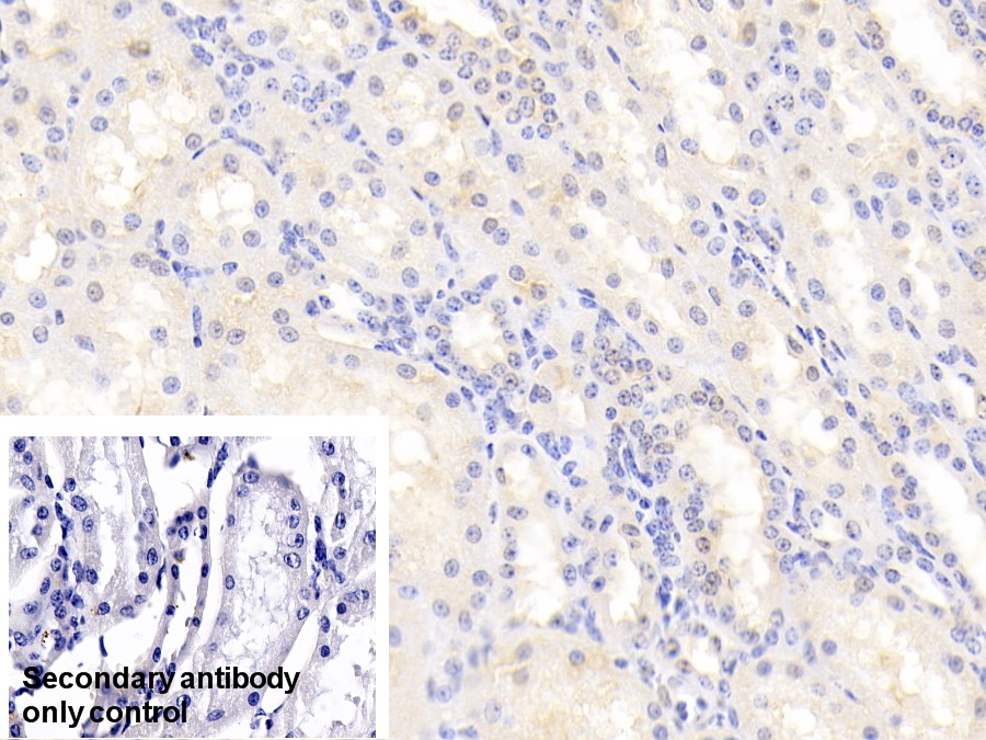 Polyclonal Antibody to Glutathione S Transferase Pi (GSTp)