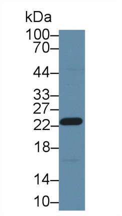 Polyclonal Antibody to Glutathione S Transferase Pi (GSTp)