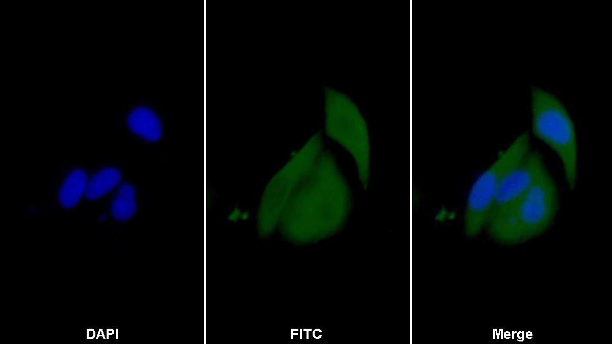 Polyclonal Antibody to Glutathione S Transferase Pi (GSTp)