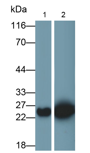 Polyclonal Antibody to Glutathione S Transferase Pi (GSTp)