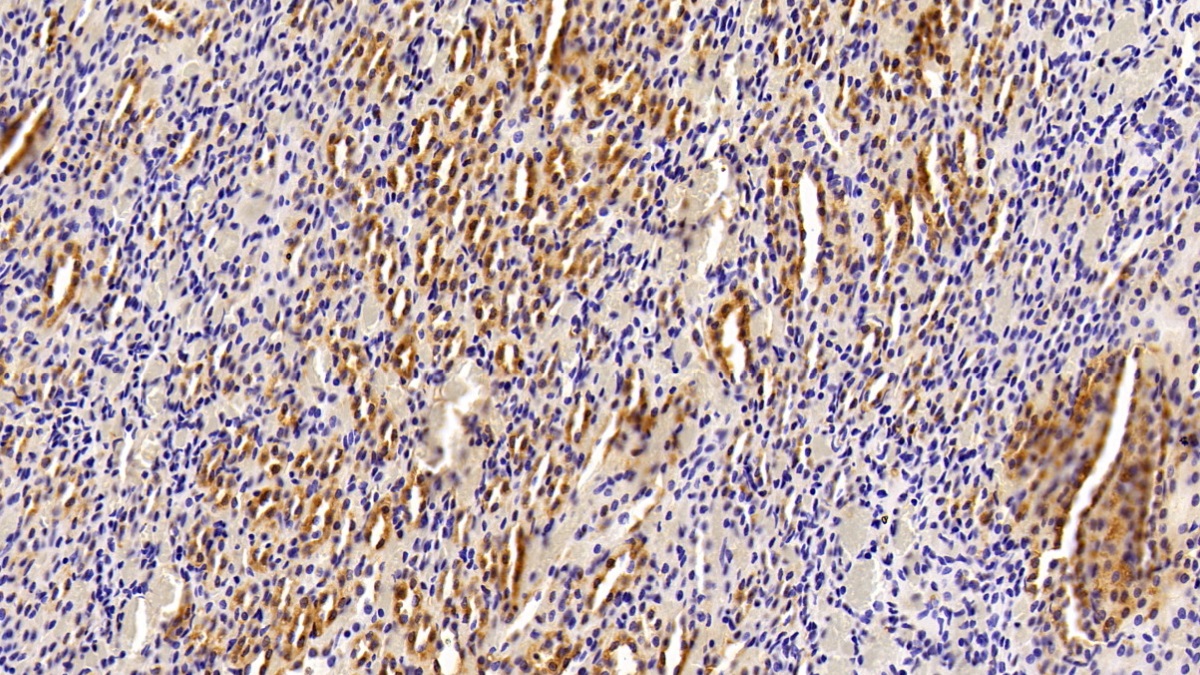 Polyclonal Antibody to Glutathione S Transferase Pi (GSTp)