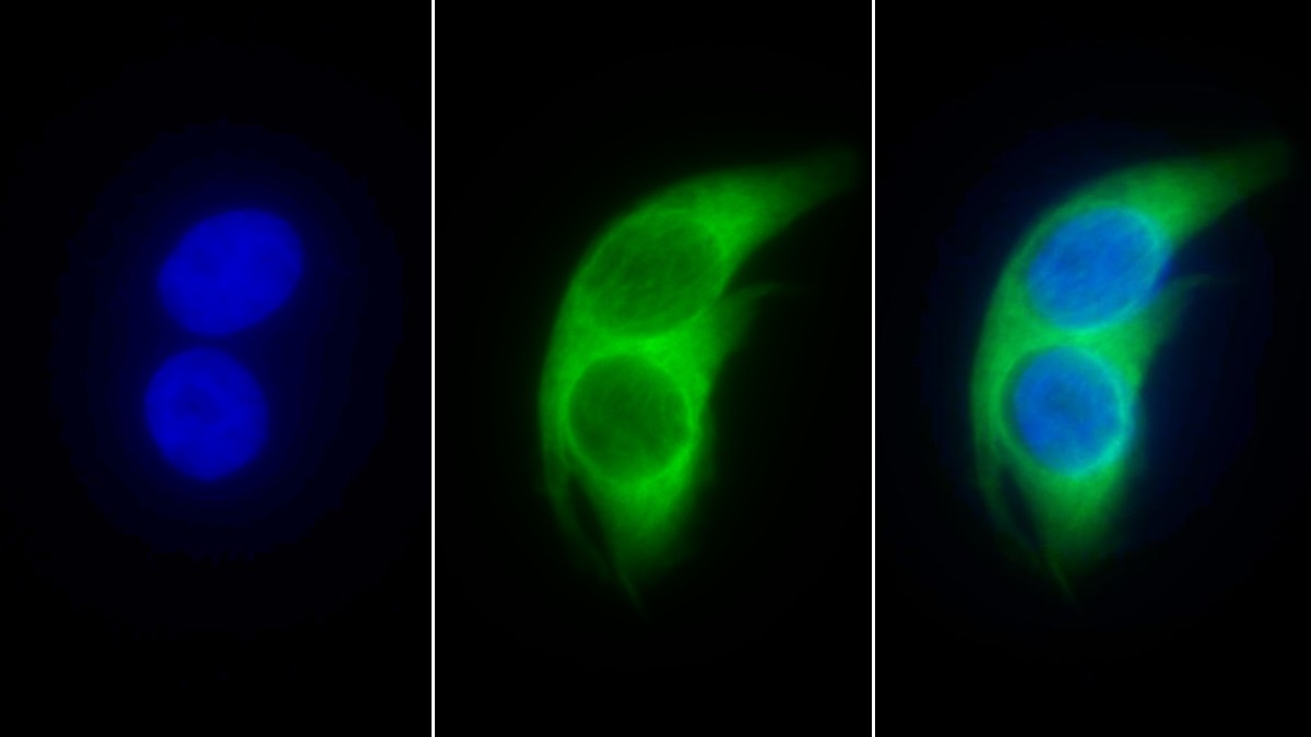 Polyclonal Antibody to Glutathione S Transferase Pi (GSTp)