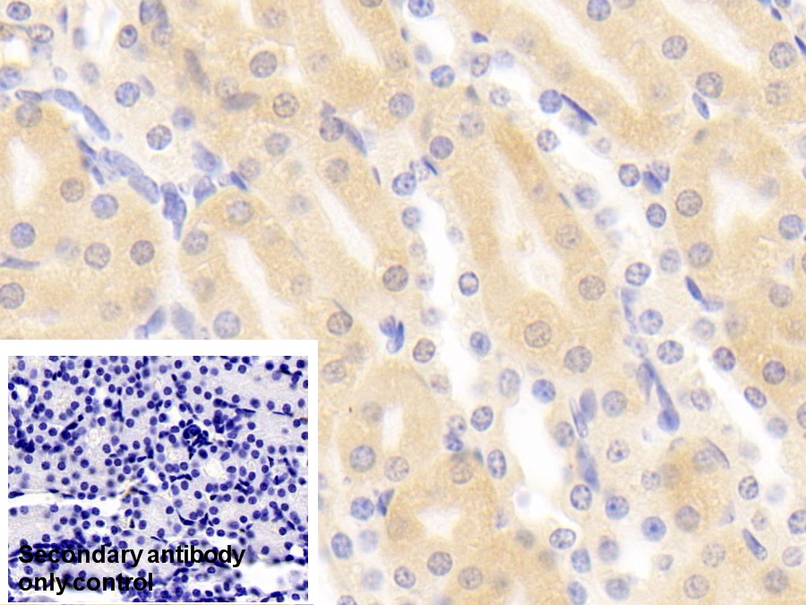 Polyclonal Antibody to Glutathione S Transferase Pi (GSTp)