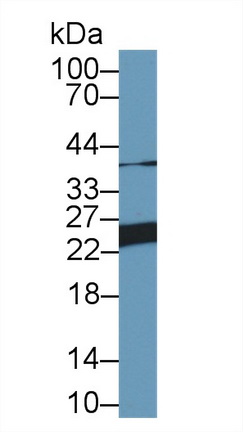 Polyclonal Antibody to Glutathione S Transferase Pi (GSTp)