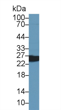 Polyclonal Antibody to Glutathione S Transferase Pi (GSTp)