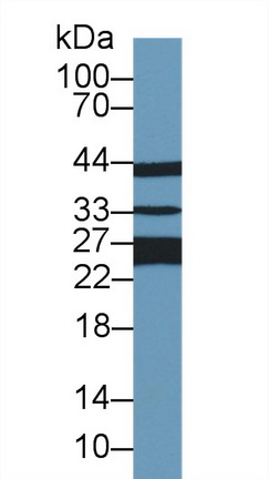 Polyclonal Antibody to Glutathione S Transferase Pi (GSTp)