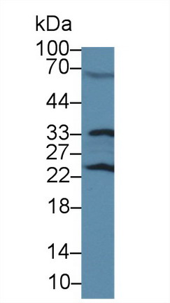 Polyclonal Antibody to Glutathione S Transferase Pi (GSTp)