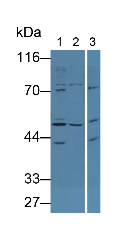 Polyclonal Antibody to Alkaline Phosphatase, Tissue-nonspecific (ALPL)