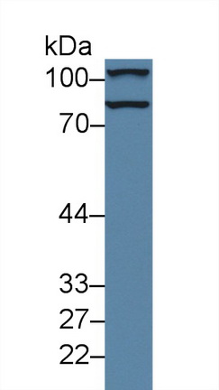 Polyclonal Antibody to Coagulation Factor XIII A1 Polypeptide (F13A1)