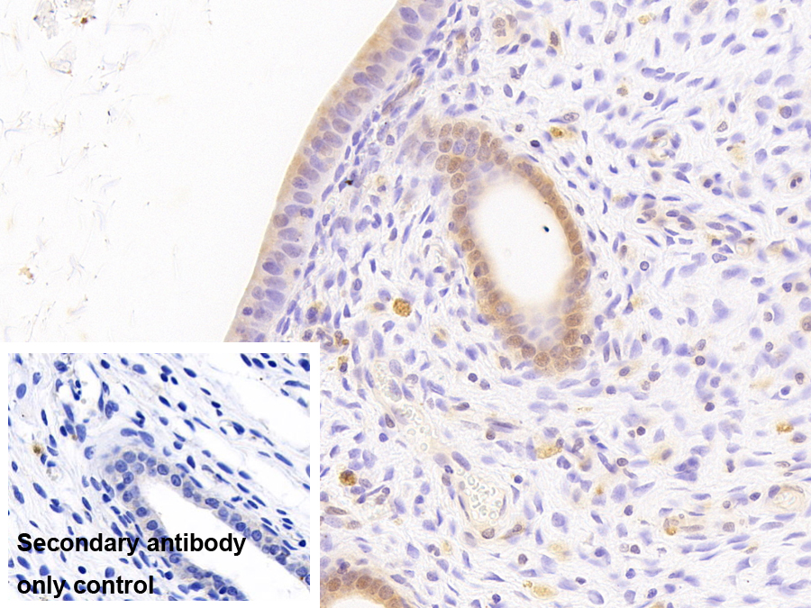 Polyclonal Antibody to Metallothionein 1 (MT1)
