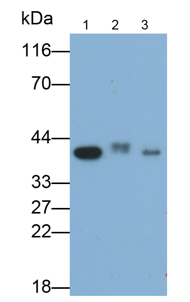 Polyclonal Antibody to Arginase (ARG)