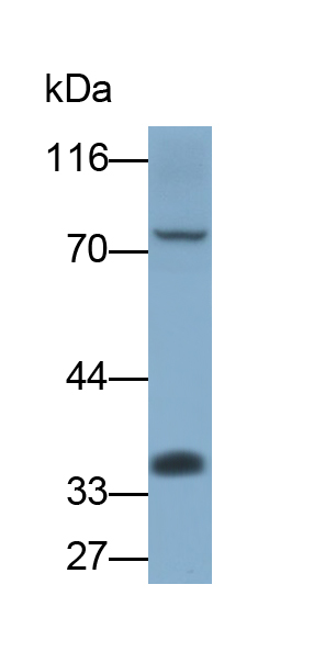Polyclonal Antibody to Membrane Spanning 4 Domains Subfamily A, Member 1 (CD20)