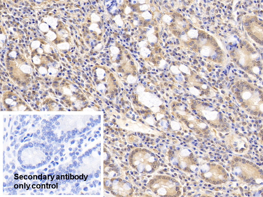 Polyclonal Antibody to Phospholipase A1 (PLA1)