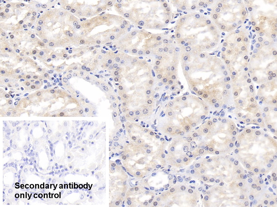 Polyclonal Antibody to Phospholipase A1 (PLA1)