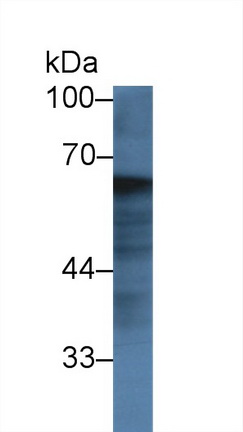 Polyclonal Antibody to Fibrinogen Alpha Chain (FGA)