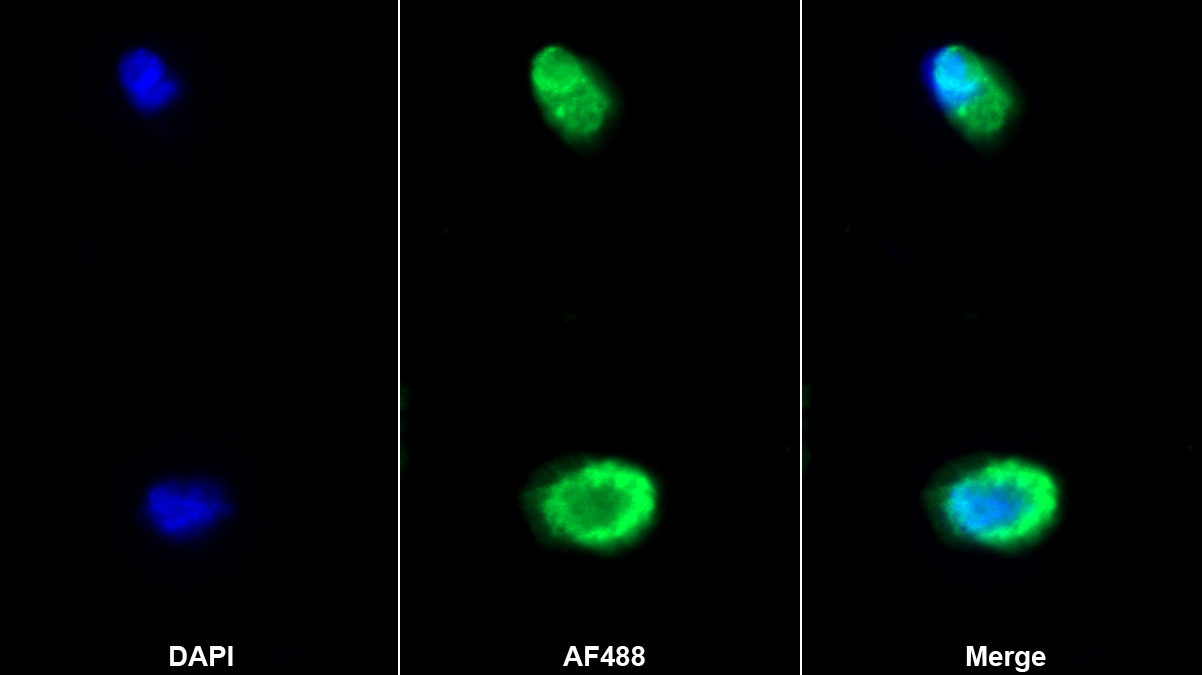 Polyclonal Antibody to Fibrinogen Alpha Chain (FGA)