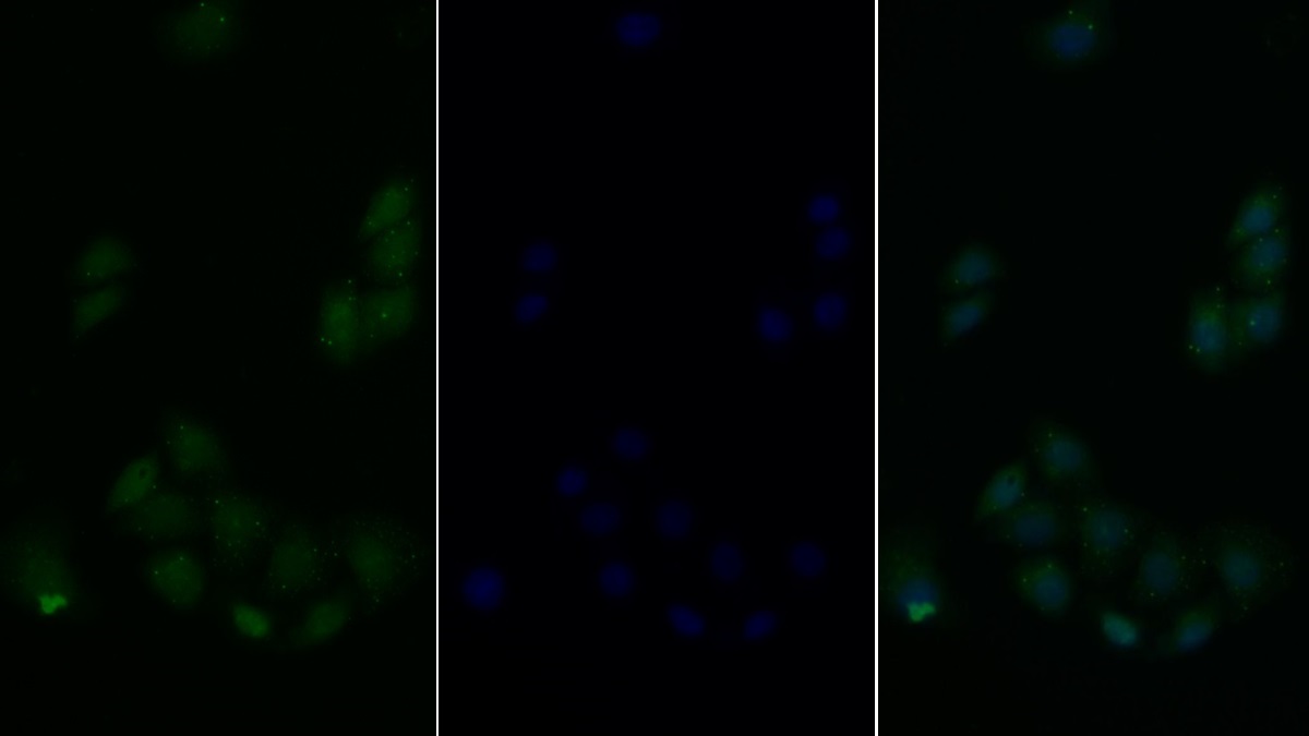 Polyclonal Antibody to c-Jun N-terminal Kinase 1 (JNK1)