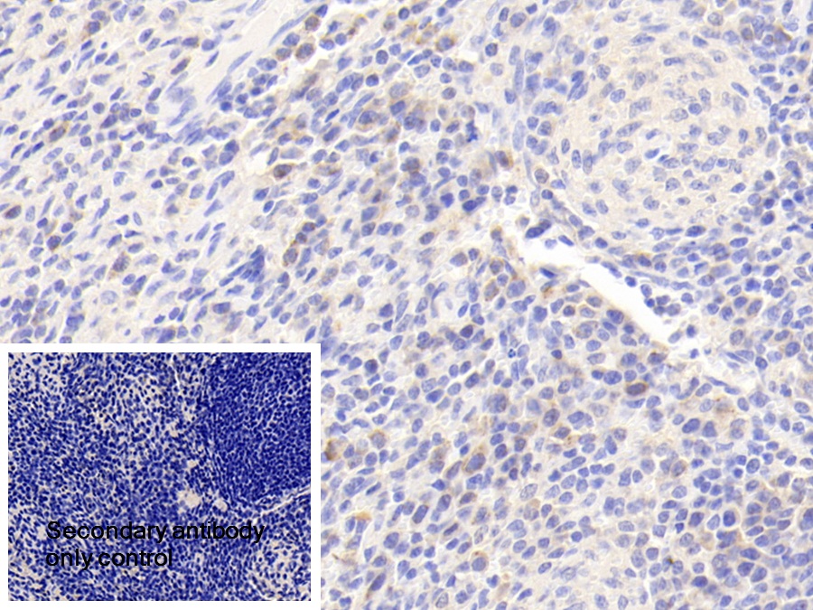 Polyclonal Antibody to c-Jun N-terminal Kinase 1 (JNK1)