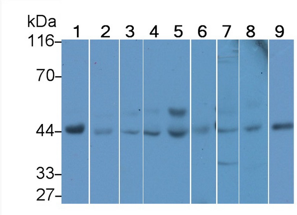 Polyclonal Antibody to c-Jun N-terminal Kinase 1 (JNK1)